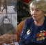 Когда болела даже кожа - ТРК 27 плюс